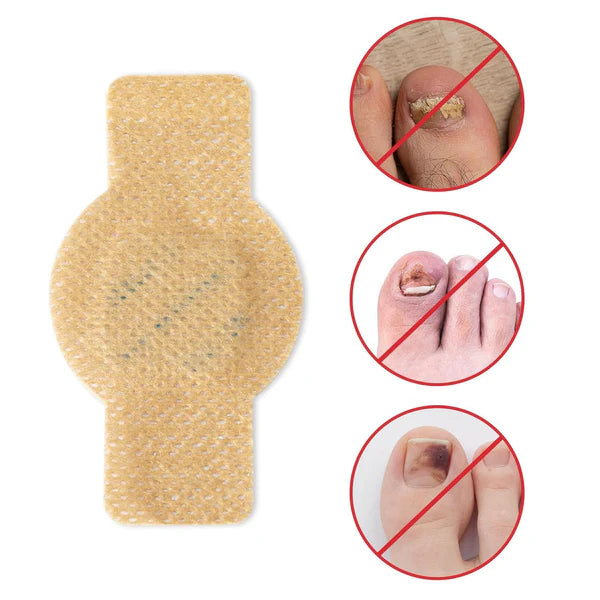 2X1 PARCHE UÑAS ANTIHONGOS